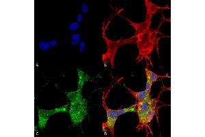 Immunocytochemistry/Immunofluorescence analysis using Mouse Anti-GFAP Monoclonal Antibody, Clone S206A-8 (ABIN1740957).