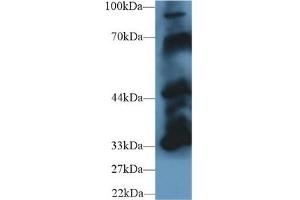 Detection of PTPN5 in Mouse Cerebrum lysate using Polyclonal Antibody to Protein Tyrosine Phosphatase, Non Receptor Type 5 (PTPN5) (PTPN5 anticorps  (AA 270-533))