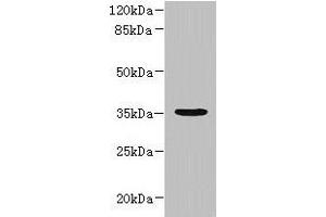 Western blot All lanes: NUBPL antibody at 1 μg/mL + A431 whole cell lysate Secondary Goat polyclonal to rabbit IgG at 1/10000 dilution Predicted band size: 35, 19 kDa Observed band size: 35 kDa (NUBPL anticorps  (AA 39-319))