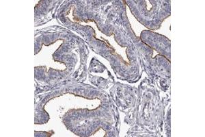 Immunohistochemical staining (Formalin-fixed paraffin-embedded sections) of human fallopian tube with GPRC5C polyclonal antibody  shows membrane positivity in glandular cells.