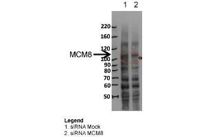 MCM8 WB Sample: siRNA Mock and siRNA MCM8 Dilution 1:1000 (MCM8 anticorps  (N-Term))