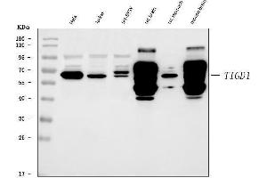 Western blot analysis of TIGD1 using anti-TIGD1 antibody (ABIN7602407).