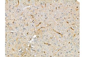 ABIN7093250 and ABIN7097267 at 1/100 staining Rat brain tissue by IHC-P. (NCF1 anticorps  (pSer345))