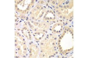 Immunohistochemistry of paraffin-embedded human kidney using SPIN2B antibody at dilution of 1:100 (x400 lens). (Spindlin 2B anticorps)