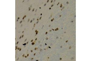Immunohistochemistry of paraffin-embedded mouse brain using NFKB2 Antibody.