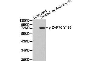 Western blot analysis of extracts from JK cells, using Phospho-ZAP70-Y493 antibody. (ZAP70 anticorps  (pTyr493))