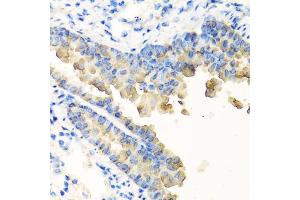 Immunohistochemistry of paraffin-embedded mouse lung using NYX antibody. (Nyctalopin anticorps)
