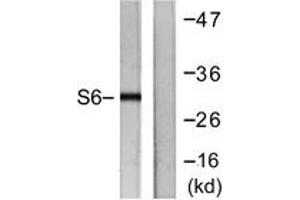 Western blot analysis of extracts from HeLa cells, treated with TNF-a 20ng/ml 2', using S6 Ribosomal Protein (Ab-240) Antibody. (RPS6 anticorps  (AA 191-240))