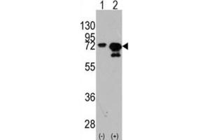 Western Blotting (WB) image for anti-Heat Shock 70kDa Protein 1A (HSPA1A) antibody (ABIN3003300) (HSP70 1A anticorps)