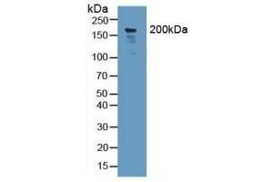 Detection of NID2 in Human Lung Tissue using Polyclonal Antibody to Nidogen 2 (NID2) (NID2 anticorps  (AA 31-289))