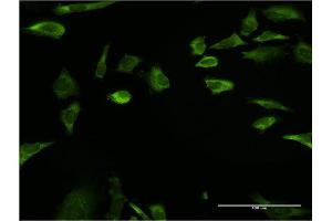 Immunofluorescence of monoclonal antibody to RPLP1 on HeLa cell.