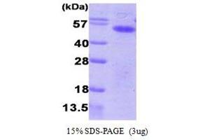 SDS-PAGE (SDS) image for Aurora Kinase A (AURKA) (AA 1-403) protein (His tag) (ABIN667117)