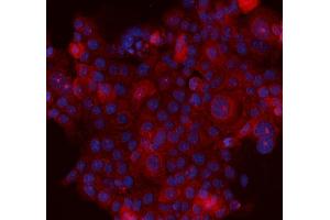 IF analysis of MASPIN/SERPINB5 using anti-MASPIN/SERPINB5 antibody (ABIN3043330).