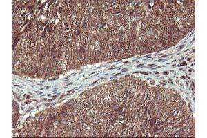 Image no. 13 for anti-Haloacid Dehalogenase-Like Hydrolase Domain Containing 1 (HDHD1) antibody (ABIN1498623) (HDHD1 anticorps)