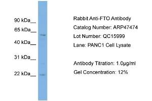 WB Suggested Anti-FTO  Antibody Titration: 0. (FTO anticorps  (Middle Region))