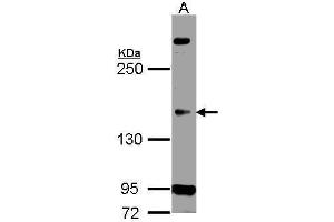 WB Image Sample (30 ug of whole cell lysate) A: H1299 5% SDS PAGE antibody diluted at 1:500 (CDK13 anticorps)
