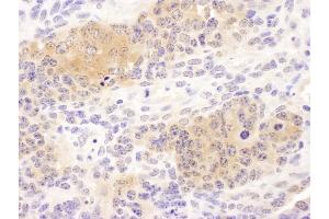 Immunohistochemistry (IHC) image for anti-Chaperonin Containing TCP1, Subunit 8 (Theta) (CCT8) (AA 448-498) antibody (ABIN7453620)