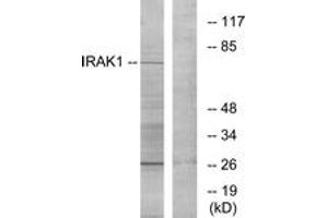 Western blot analysis of extracts from NIH-3T3 cells, using IRAK1 (Ab-209) Antibody. (IRAK1 anticorps  (AA 175-224))