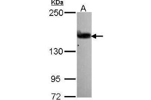 WB Image Sample (30 ug of whole cell lysate) A: A431 , 5% SDS PAGE antibody diluted at 1:1000 (ARHGEF5 anticorps  (N-Term))