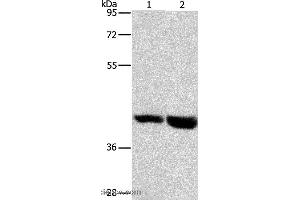 Western blot analysis of Mouse heart and liver tissue, using GPR182 Polyclonal Antibody at dilution of 1:1000 (G Protein-Coupled Receptor 182 anticorps)