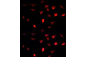 Immunofluorescence analysis of L929 cells using BRC antibody (1318) at dilution of 1:100. (BRCA1 anticorps  (AA 400-699))
