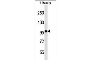FGD4 Antibody (N-term) (ABIN656907 and ABIN2846104) western blot analysis in human normal Uterus tissue lysates (35 μg/lane). (FGD4 anticorps  (N-Term))
