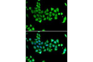 Immunofluorescence analysis of A549 cells using HSPA14 antibody. (HSPA14 anticorps  (AA 240-509))