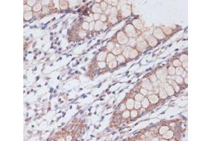 Immunohistochemistry of paraffin-embedded Human colon using MBTPS1 Polyclonal Antibody at dilution of 1:100 (40x lens). (MBTPS1 anticorps)