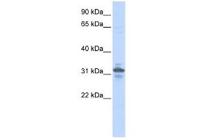 RPIA antibody used at 1 ug/ml to detect target protein. (Ribose 5-Phosphate Isomerase A (RPIA) anticorps)