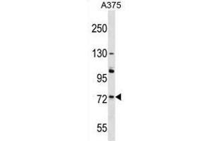 ACOX2 Antibody (N-term) western blot analysis in A375 cell line lysates (35 µg/lane). (Acox2 anticorps  (N-Term))