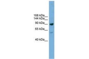 Image no. 1 for anti-DEAD (Asp-Glu-Ala-Asp) Box Polypeptide 54 (DDX54) (AA 751-800) antibody (ABIN6744608) (DDX54 anticorps  (AA 751-800))
