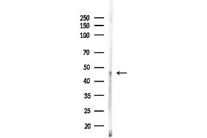 anti-Alanine-Glyoxylate Aminotransferase 2-Like 2 (AGXT2L2) (C-Term) antibody