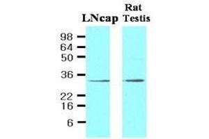 Cell lysates of LNcap (30ug) and Rat testis (30ug) were resolved by SDS-PAGE, transferred to NC membrane and probed with anti-human STEAP1 (1:500). (STEAP1 anticorps  (AA 1-70))