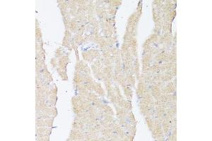 Immunohistochemistry of paraffin-embedded mouse heart using BMPR2 antibody (ABIN7265906) at dilution of 1:100 (40x lens).