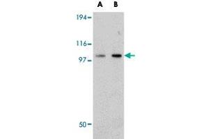 Western blot analysis of FAM120B in rat thymus tissue lysate with FAM120B polyclonal antibody  at (A) 0. (FAM120B anticorps  (C-Term))