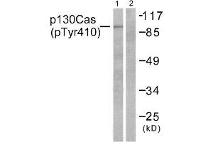 Western Blotting (WB) image for anti-Breast Cancer Anti-Estrogen Resistance 1 (BCAR1) (pTyr410) antibody (ABIN1847248) (BCAR1 anticorps  (pTyr410))