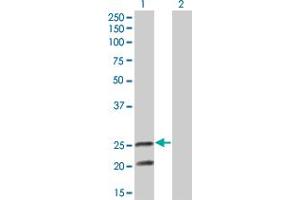 Western Blot analysis of IL6 expression in transfected 293T cell line by IL6 monoclonal antibody (M05), clone 3E8. (IL-6 anticorps  (AA 29-212))
