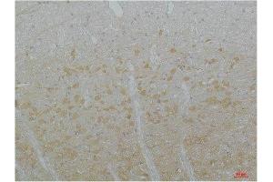 Immunohistochemical analysis of paraffin-embedded Rat Brain Tissue using Cav3.