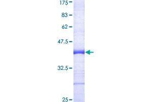 Image no. 1 for TNF Receptor-Associated Factor 7 (TRAF7) (AA 61-160) protein (GST tag) (ABIN1323520)