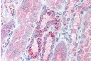Human Kidney (formalin-fixed, paraffin-embedded) stained with TFAM antibody ABIN214152 at 5 ug/ml followed by biotinylated goat anti-rabbit IgG secondary antibody ABIN481713, alkaline phosphatase-streptavidin and chromogen.