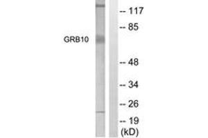 Western Blotting (WB) image for anti-Growth Factor Receptor-Bound Protein 10 (GRB10) (AA 33-82) antibody (ABIN2888873) (GRB10 anticorps  (AA 33-82))
