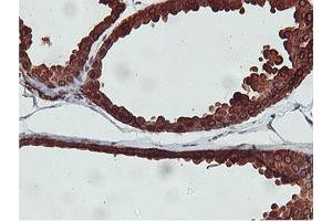 Immunohistochemical staining of paraffin-embedded Human breast tissue using anti-C20orf3 mouse monoclonal antibody. (APMAP anticorps)