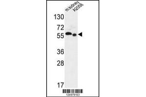 Western blot analysis in mouse kidney tissue and A2058 cell line lysates (35ug/lane).