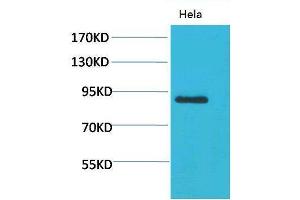 Western Blot (WB) analysis of HeLa using Stat4 Polyclonal Antibody. (STAT4 anticorps)