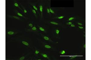 Immunofluorescence of purified MaxPab antibody to HDGFRP3 on HeLa cell. (HDGFRP3 anticorps  (AA 1-203))