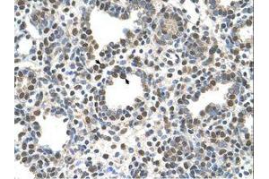 Image no. 1 for anti-Zinc Finger, DHHC-Type Containing 13 (ZDHHC13) (N-Term) antibody (ABIN205045)