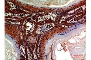 Immunohistochemistry (IHC) analysis of paraffin-embedded Human Skin, antibody was diluted at 1:200. (ADAMTS18 anticorps)