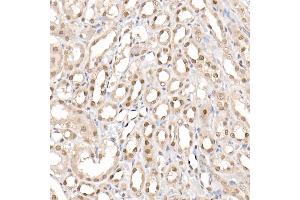 Immunohistochemistry of paraffin-embedded rat kidney using [KO Validated] PRMT4/C Rabbit pAb (ABIN1682307, ABIN3015886, ABIN3015887 and ABIN6219468) at dilution of 1:25 (40x lens).