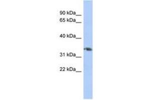 Image no. 1 for anti-Homeobox D10 (HOXD10) (AA 143-192) antibody (ABIN6744410) (HOXD10 anticorps  (AA 143-192))