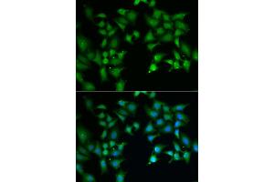 Immunofluorescence analysis of A549 cell using FLOT2 antibody. (Flotillin 2 anticorps)